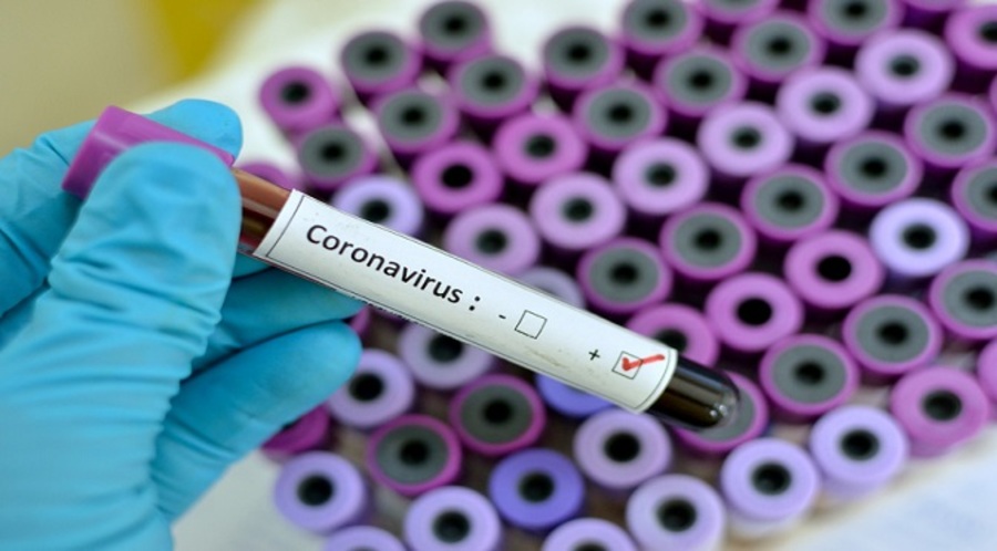 Center coronavirus tubetes